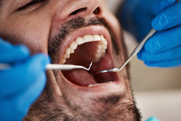 Best Emergency Dental Care for Trauma or Injury in Hidden Valley, IN